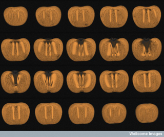 Illustration for article titled This Is How Your Fruits and Vegetables Look in an MRI Machine